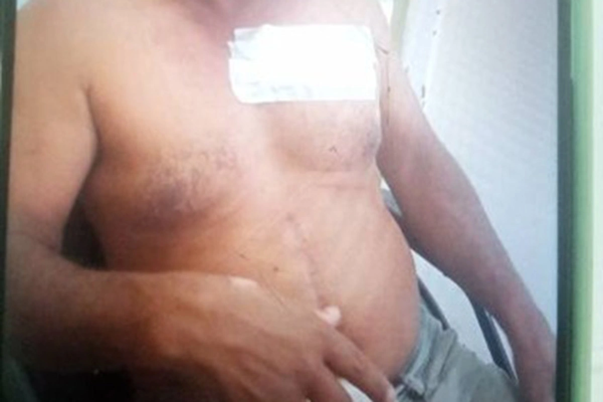 Homem é ferido com golpe de faca em Palmas de Monte Alto