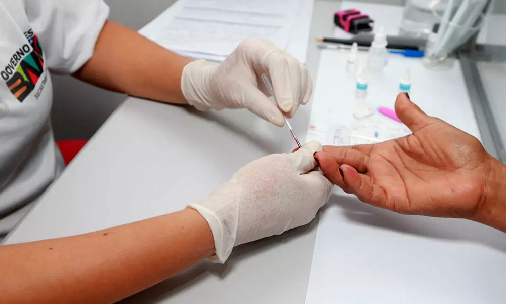 Sesab desmente boatos sobre surto de HIV/Aids entre jovens na Bahia