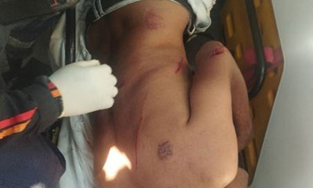 Homem é ferido com golpes de facão após briga entre irmãos em Palmas de Monte Alto