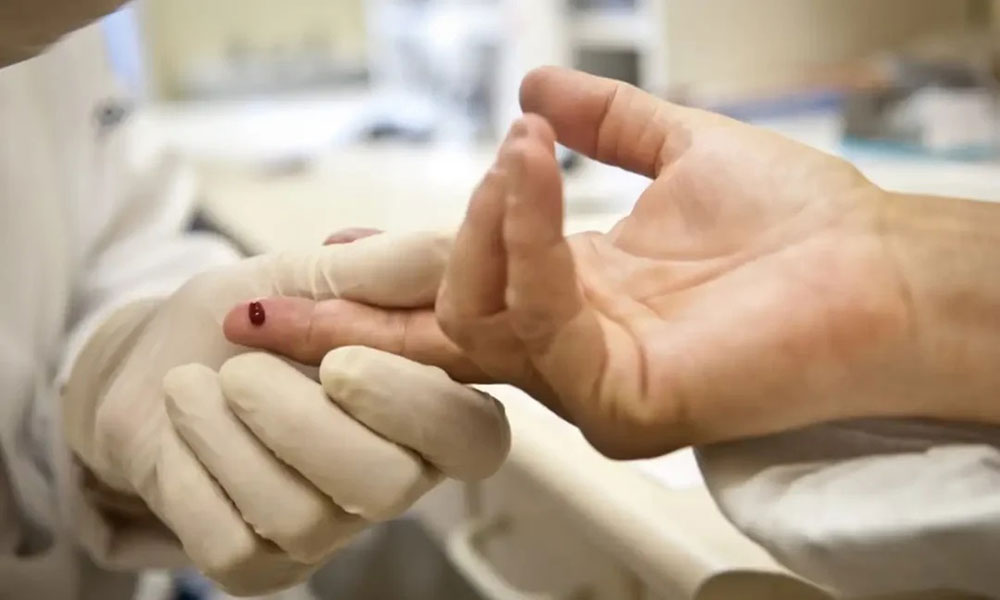 Brasil elimina transmissão vertical do HIV e alcança menor taxa de mortalidade dos últimos anos